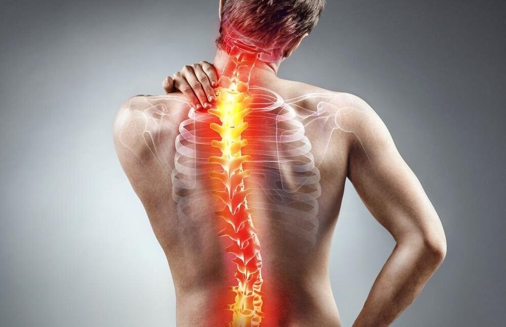 Osteochondrosis back pain
