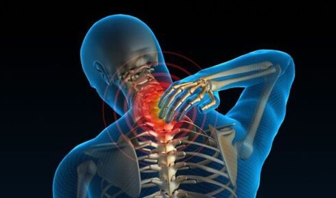 Cervical pain with osteochondrosis