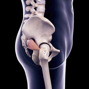 Dagger back pain may be due to piriformis spasm