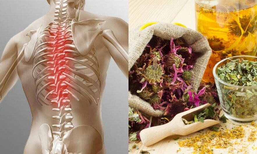 Traditional Recipes - Prevent the Development of Osteochondrosis and Support Spinal Health