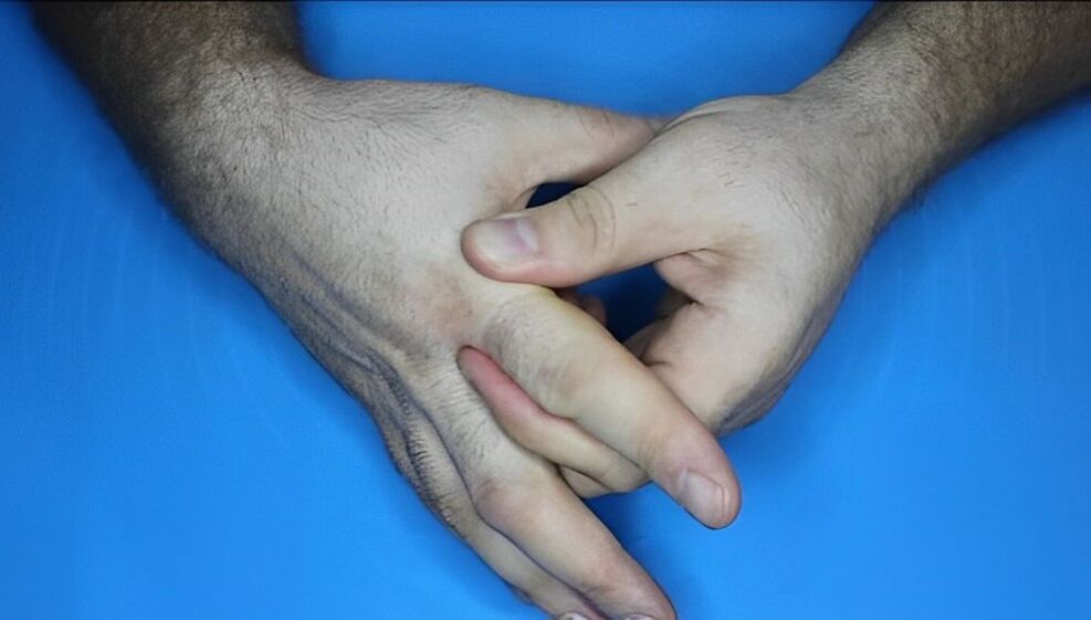 Exercises for arthritic fingers