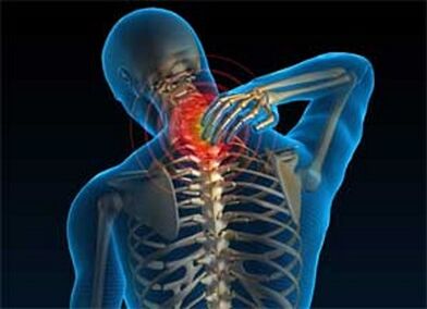 Neck pain is a common symptom of osteocartilage degeneration