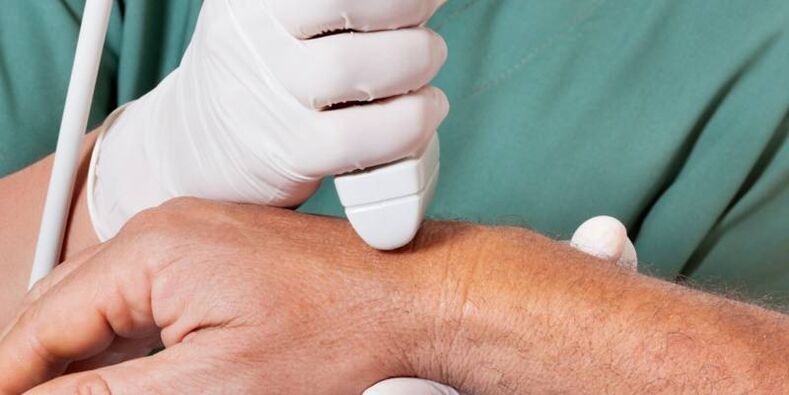 Arthritis is the cause of joint pain in the fingers