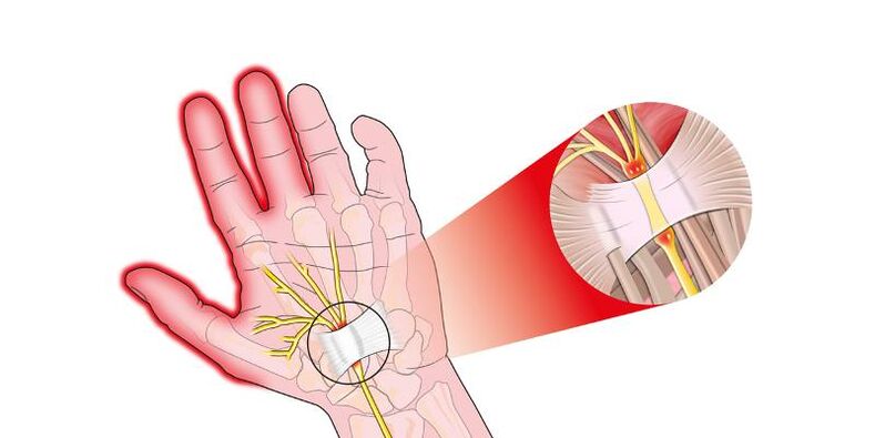 Finger joint pain